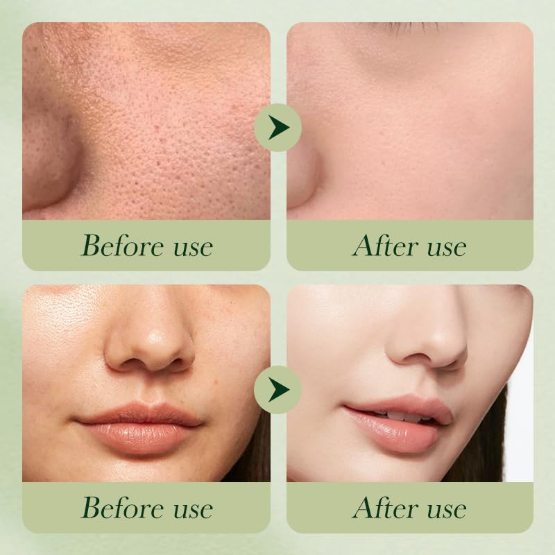 Avocado Skincare Sets, 6Pcs Skincare Gift Set with Facial Cleanser, Face Serum, Face Cream, Eye Cream, Toner, moisturizing Lotion, Anti Aging Skin Care Sets & Kits, Hydrating Facial Kit for women