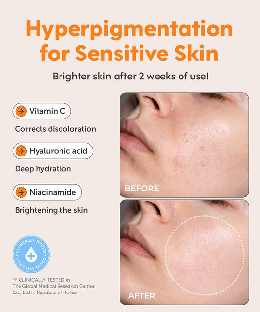 The Best Brightening Products for Hyperpigmentation in the U.S.
