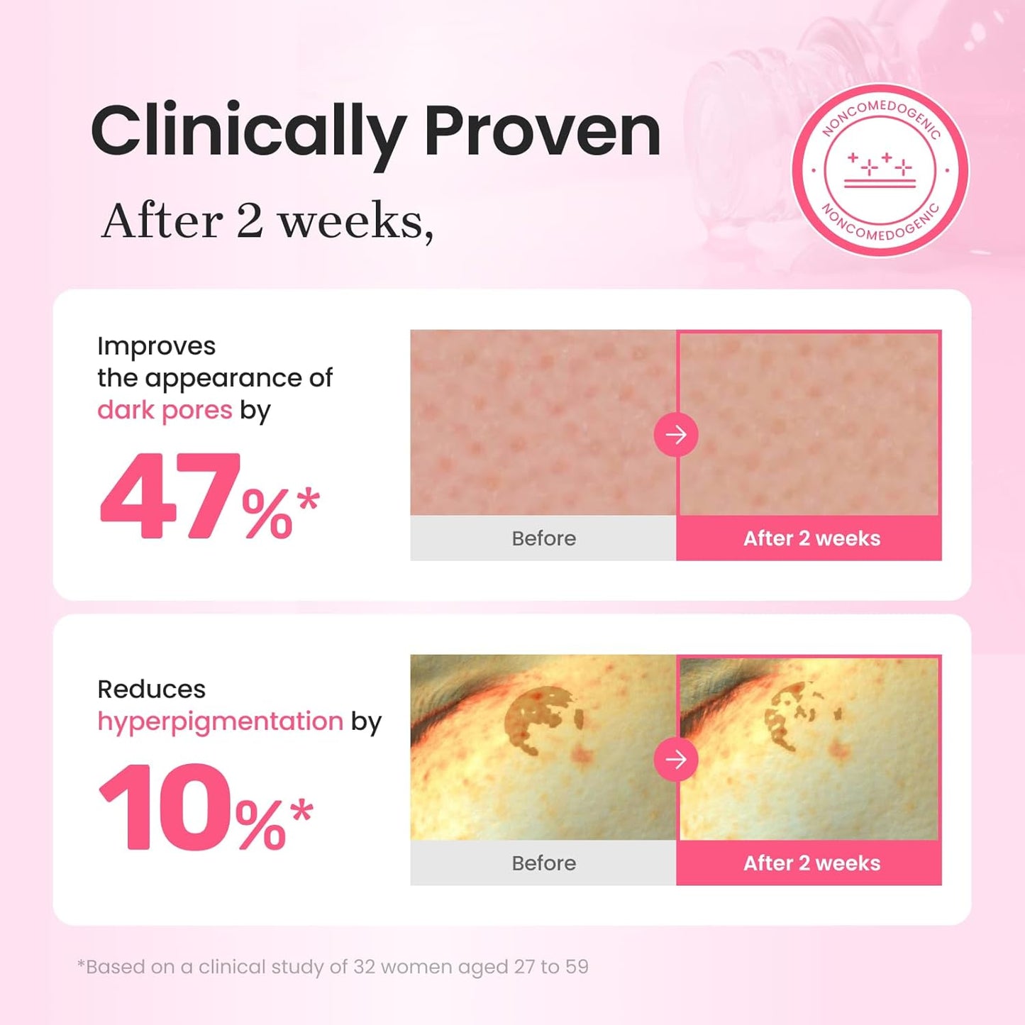 CNP PDRN + Tranexamic Acid Serum 15%, Pink Toning Skin Booster, Niacinamide & Micro-spicules, for Glass Skin, Korean Skin Care, 1. 18 fl. oz.