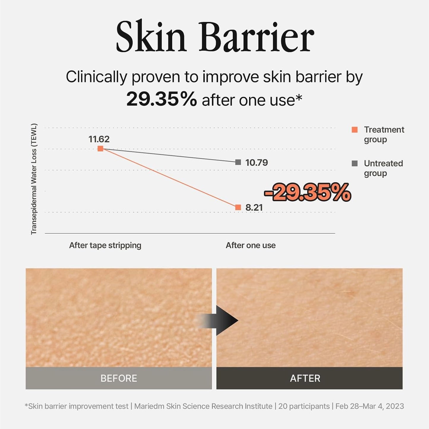 Silver Bottle, Refill - Facial Barrier Mist with 80% Witch Hazel Water, Cica for Skin Barrier Repair, Recovery Mist for Sensitive Skin, Dewy Hydration, Korean Skin Care (15.22 fl oz)