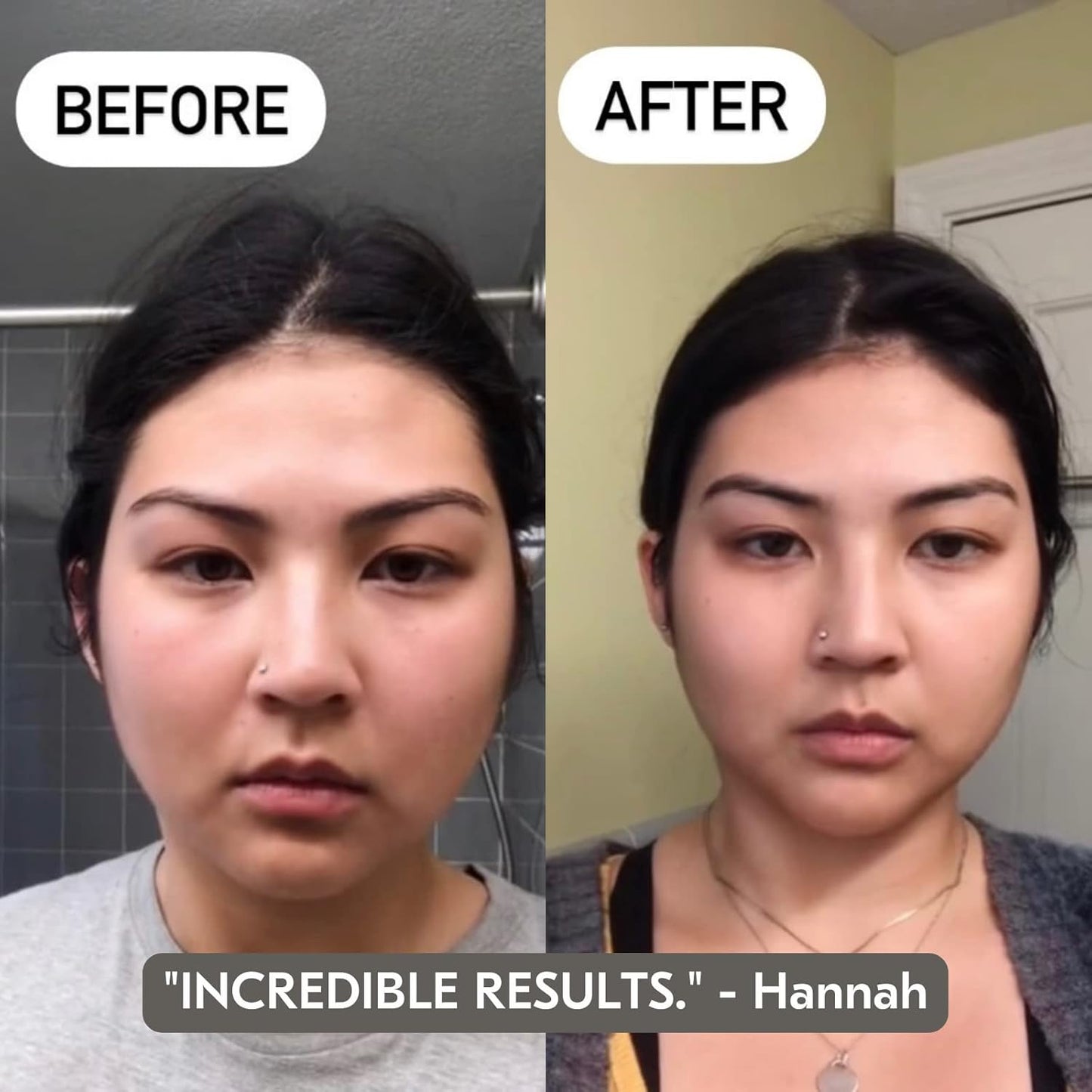 Mount Lai Amethyst Gua Sha Facial Tool – The Stone of Inner Clarity – 100% Genuine Amethyst Stone Face Sculpting Tool for Lymphatic Drainage, Puffiness Reduction & Confident Radiance