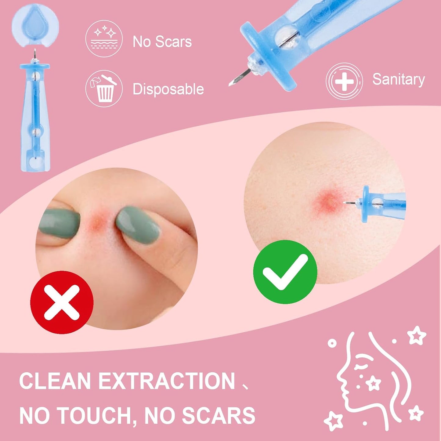 Pimple Patches Set with Microdart Pimples Patche and Hydrocolloid Patch – 3-Step Acne Kit for Fast Blemish Removal, Blackhead Extractor Tools, Zit Patches for Face