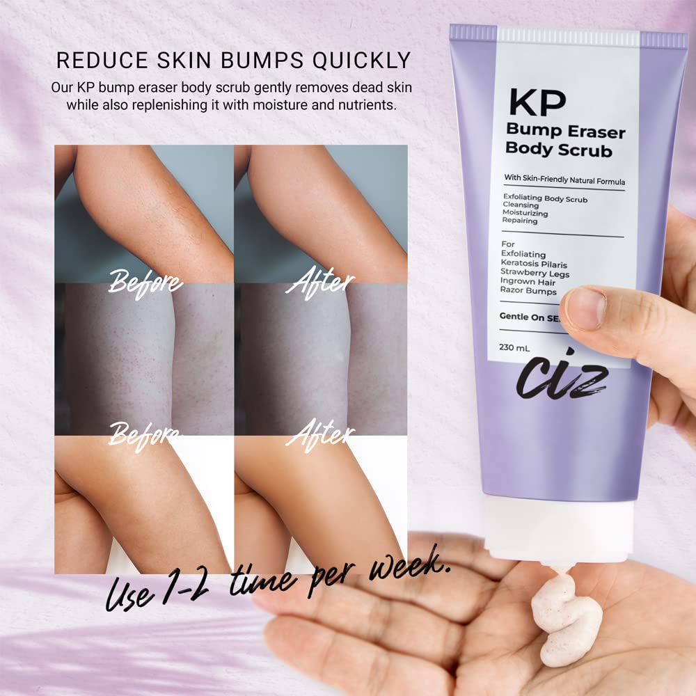 KP Bump Eraser Body Scrub: Keratosis Pilaris Treatment for Strawberry Skin & Ingrown Hair - Exfoliates and Smooths Rough, Dry Skin on Arms, Legs, and Bikini Area – Gentle Bump Eraser for Body Wash