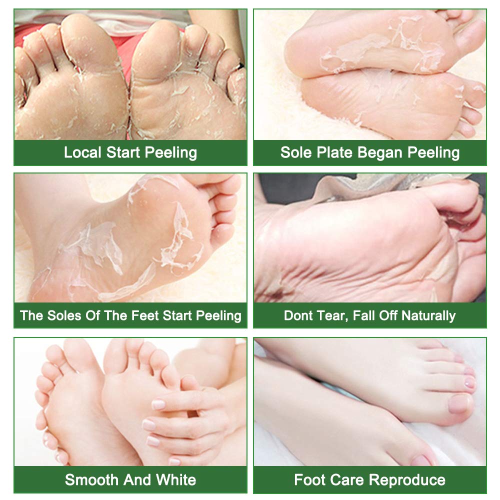 Foot Peeling Mask Moisturizing Socks 5Pairs, Foot Mask Remove Dead Skin, Rough Callus and Cracked Heels, Dry Skin Moisturizer for Soft and Smooth Baby Touch Feet (Tea Tree)