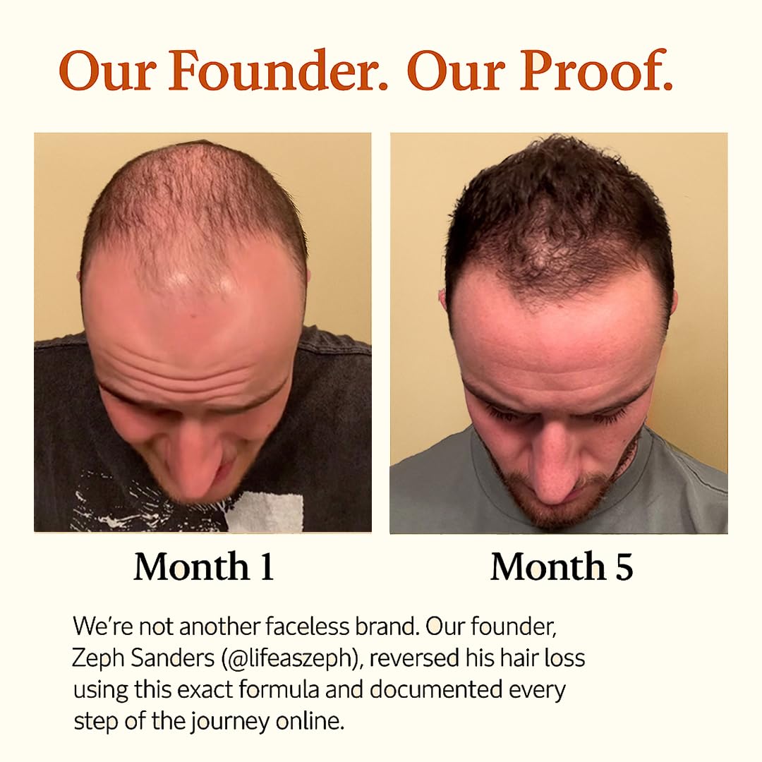 The Mane Elixir Blend: 11-in-1 Growth Oil Serum for Thinning Hair, Loss & Regrowth - 50ml