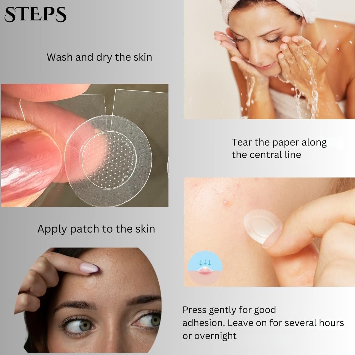 Microdart Spot Patch | Targeted Blemish Care with Salicylic Acid, Azelaic Acid, Niacinamide and Willowherb | For Early-Stage Blemishes | 8 Patches