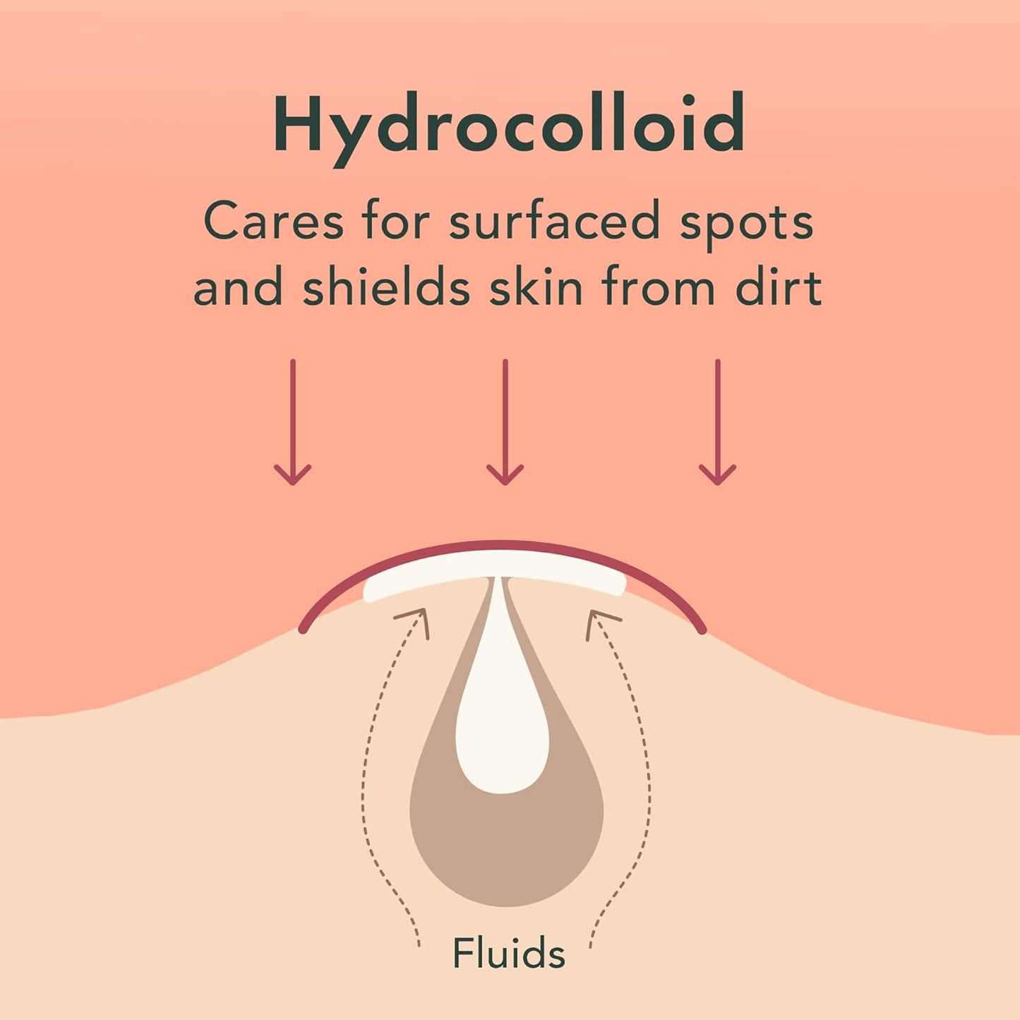 Rael Pimple Patches, Miracle Invisible Spot Cover - Hydrocolloid Acne Patch, Treatment for Breakouts, Absorbs Zits & Blemish, Korean Skin Care, 2 Sizes (48 Count)