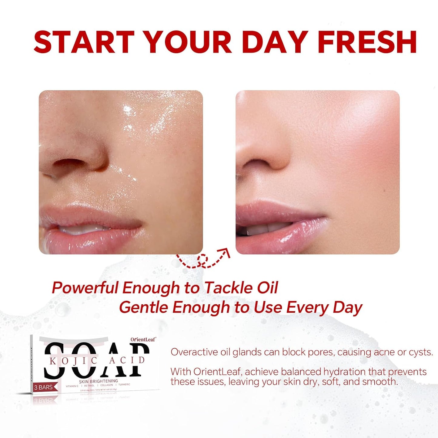 Kojic Acid Soap, Turmeric Soap Bar for Dark Spots, Fresh Citurs Scent, Gentle for Face and Body Wash with Vitamin C, Shea Butter, Retinol, Olive Oil, Collagen (3 PACK)