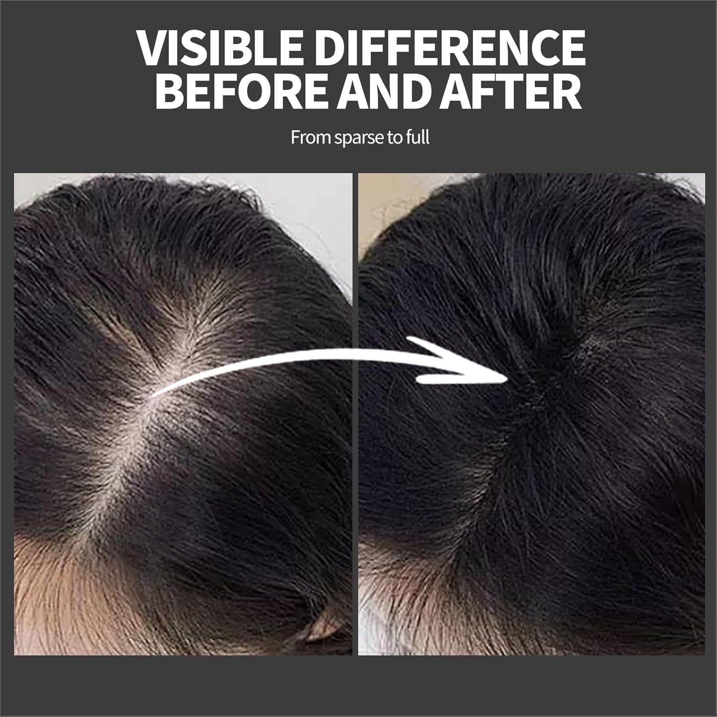 Hair Building Fibers - Instant Volume for Thinning Hair, Natural Appearance with Electrostatic Adsorption,Plant-Based, All-Day Hold, 25G Dark brown