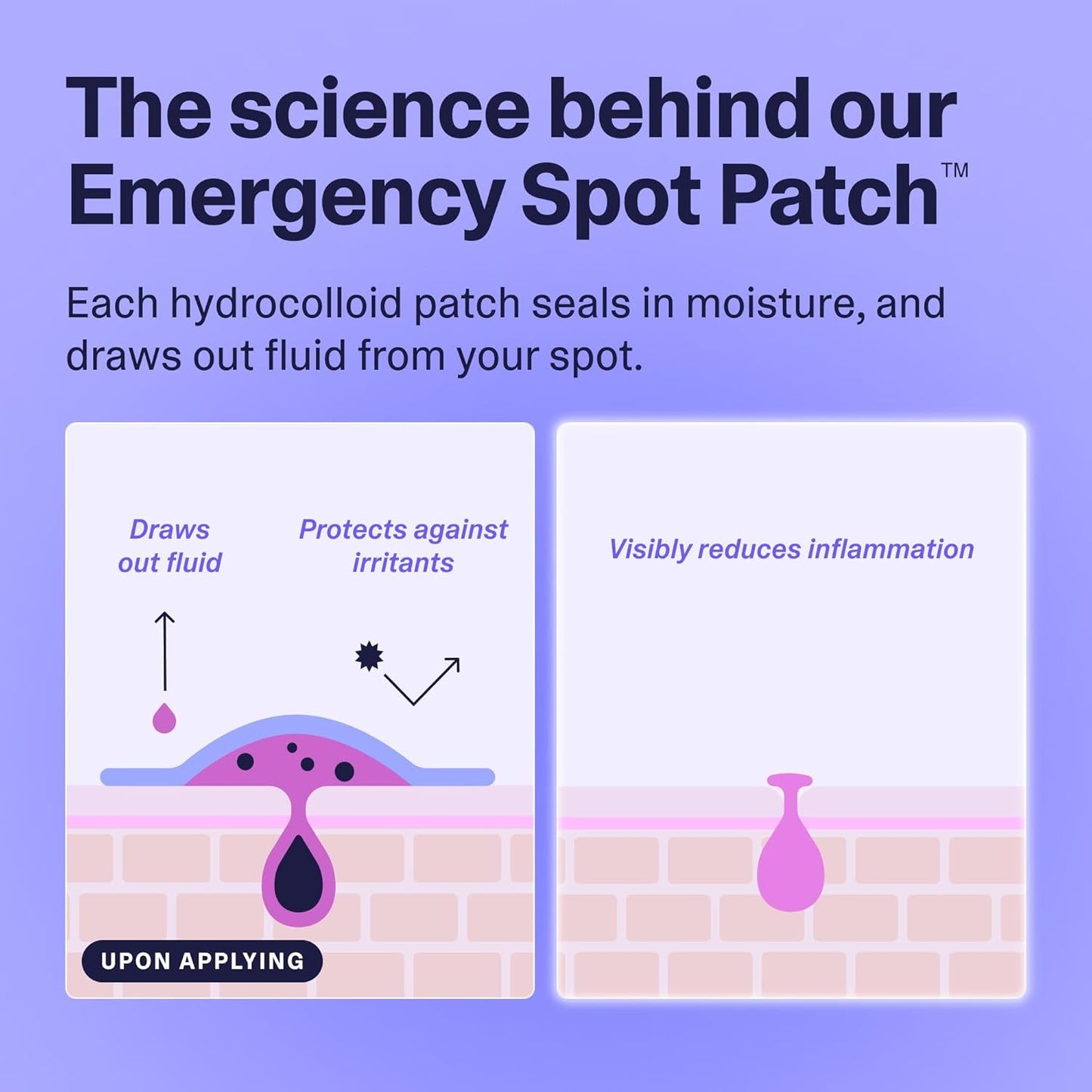 Curology Emergency Spot Pimple Patches for Face, Hydrocolloid Pimple Patches Fast-Acting, 40 Count