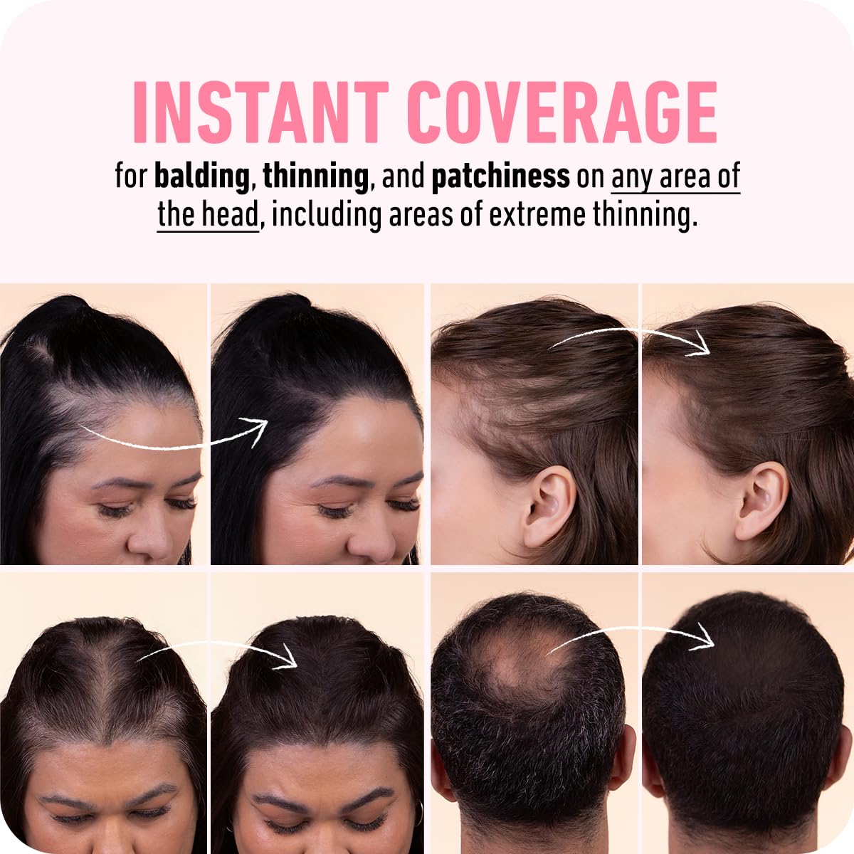 BOLDIFY Hairline Powder - Root Touch Up Hair Color for Gray Coverage - Bald Spot Concealing Hair Powder for Women & Men - 48-Hour Stain-Proof - Dark Auburn