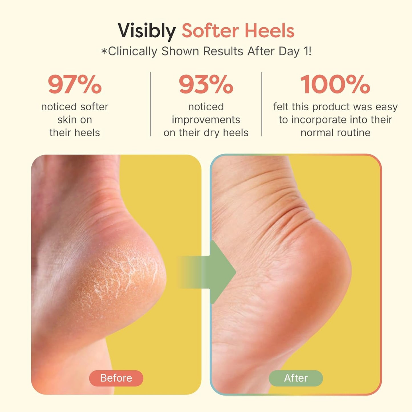 ZenToes Moisturizing Socks for Cracked Heel Treatment - Vitamin E, Olive Oil and Jojoba Oil Infused Heel Socks to Soften and Hydrate (Fuzzy Lilac Purple, Regular)