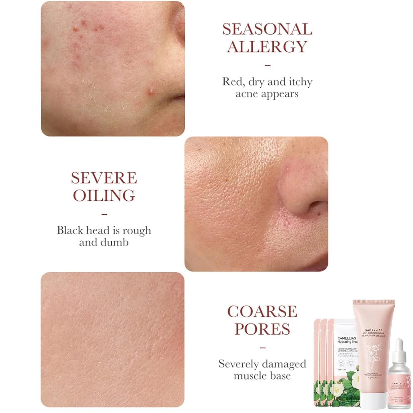 Camellia Extract Skin Care Sets, Skin Care Gift Set for Women Girls, Face Skin Care Routine Kit for Women, 5Pcs Skin Care Products Set with Cleanser,Mask, Face Serum