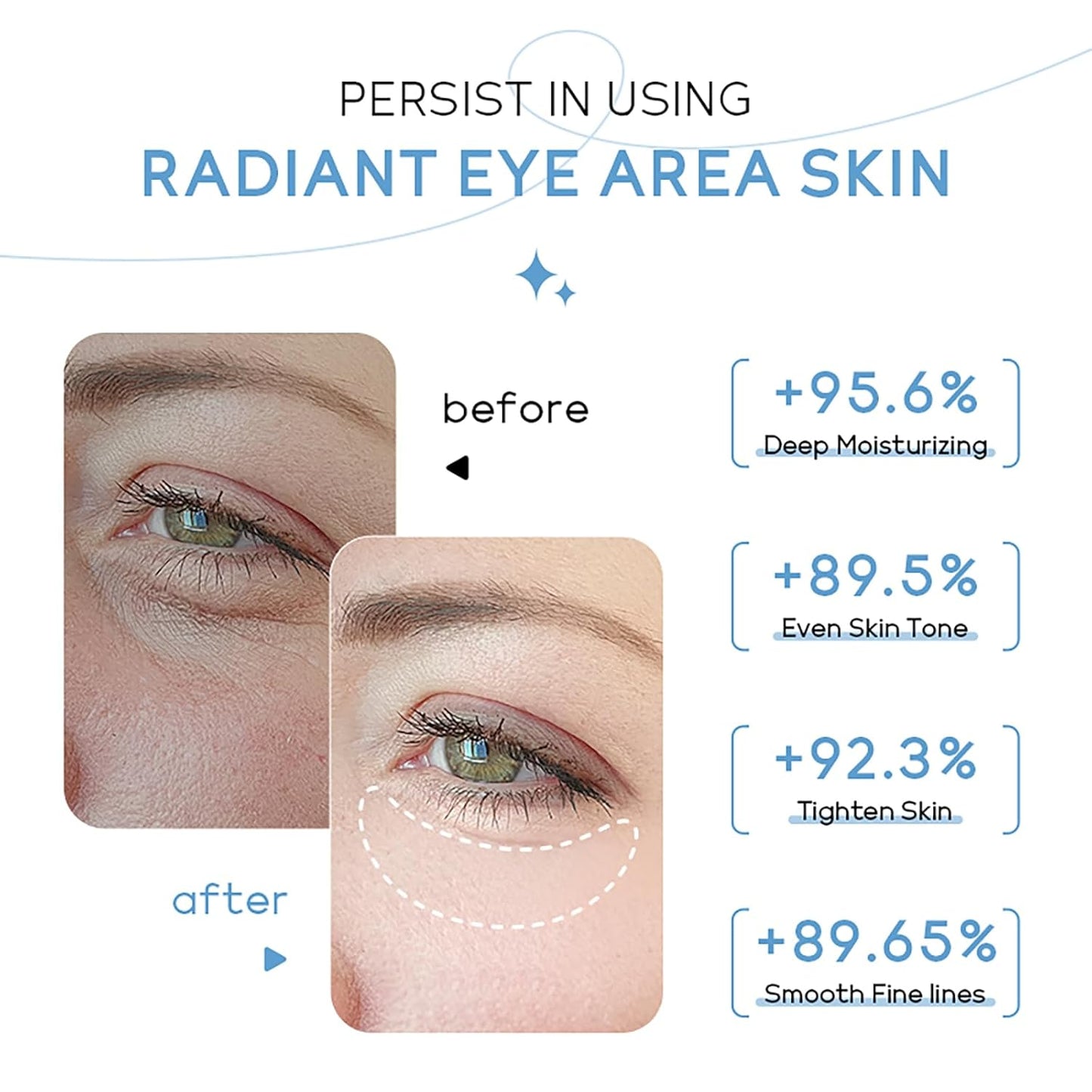 ARAKY Milk Under Eye Cream Roll-On, Triple Roll & Glow the Skin Around The Eyes, Eye Serum For Dullness, Dryness, Fine Lines, Repair Wrinkles Under The Eyes, Intense Hydrating Eye Treatment Serum Oil