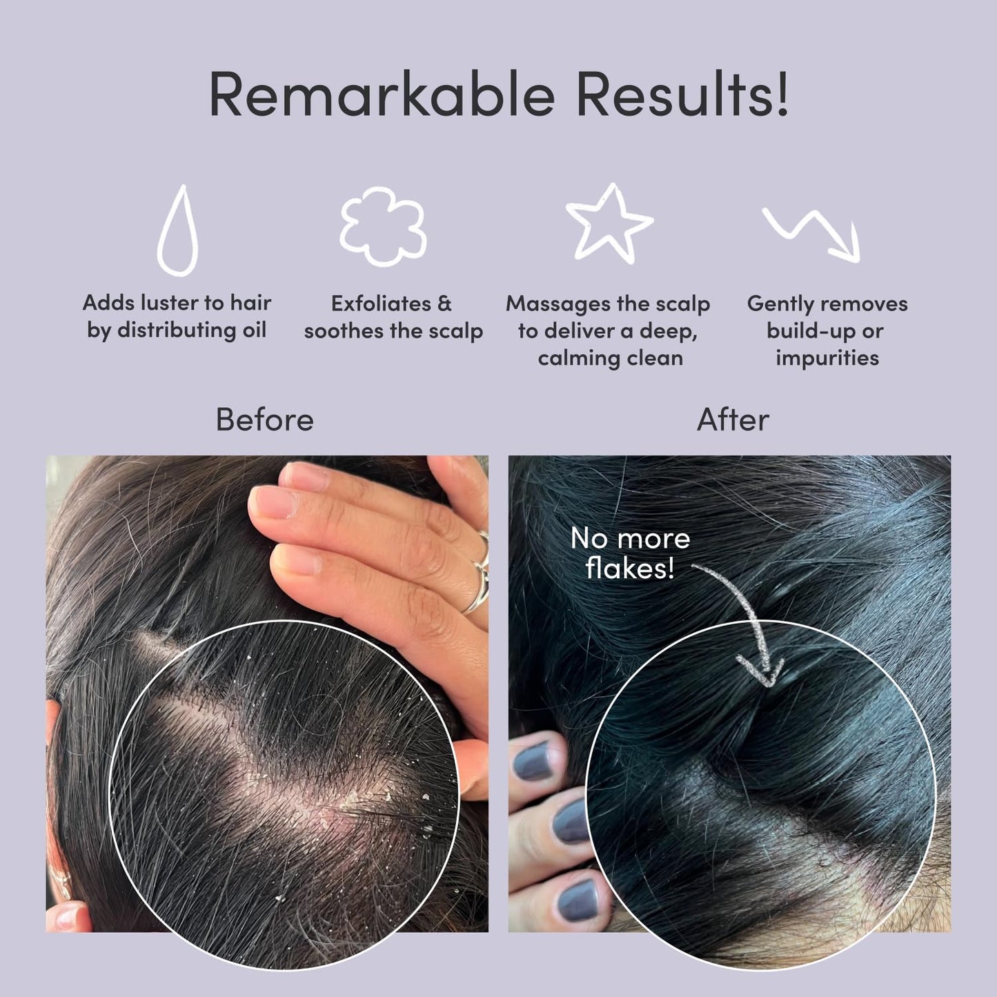 Jupiter Scalp Exfoliator - Scalp Massager Tool for Wet & Dry Hair - Ergonomic Detangler Brush - Dandruff Comb & Scrub to Remove Dandruff & Buildup and Support Circulation - Black/White