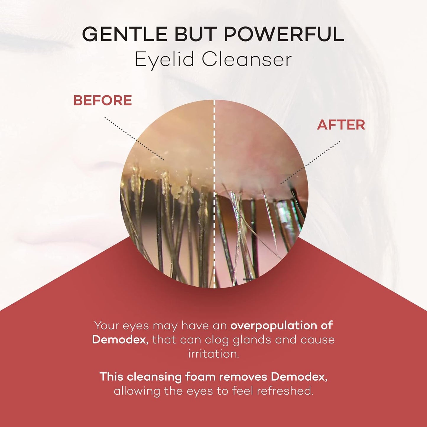 ZocuFoam Eyelid Cleanser - Foaming Eyelid Scrub - Natural pH Balanced Solution - 1.7 FL OZ (50mL)