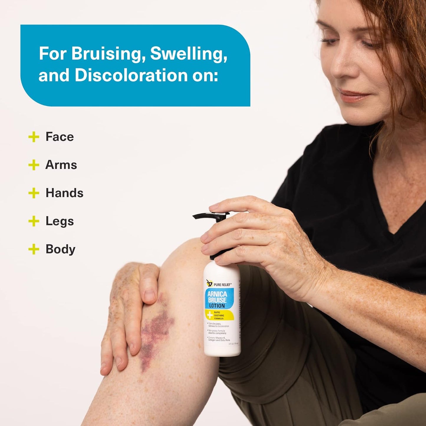 Arnica Cream Bruise Relief Lotion for Bruising and Swelling On Skin | Bruise Cream Extra Strength Vitamin K Cream | Moisturizing Arnica Bruise Formula Skin Care Gel W/Collagen, 4 Fl Oz