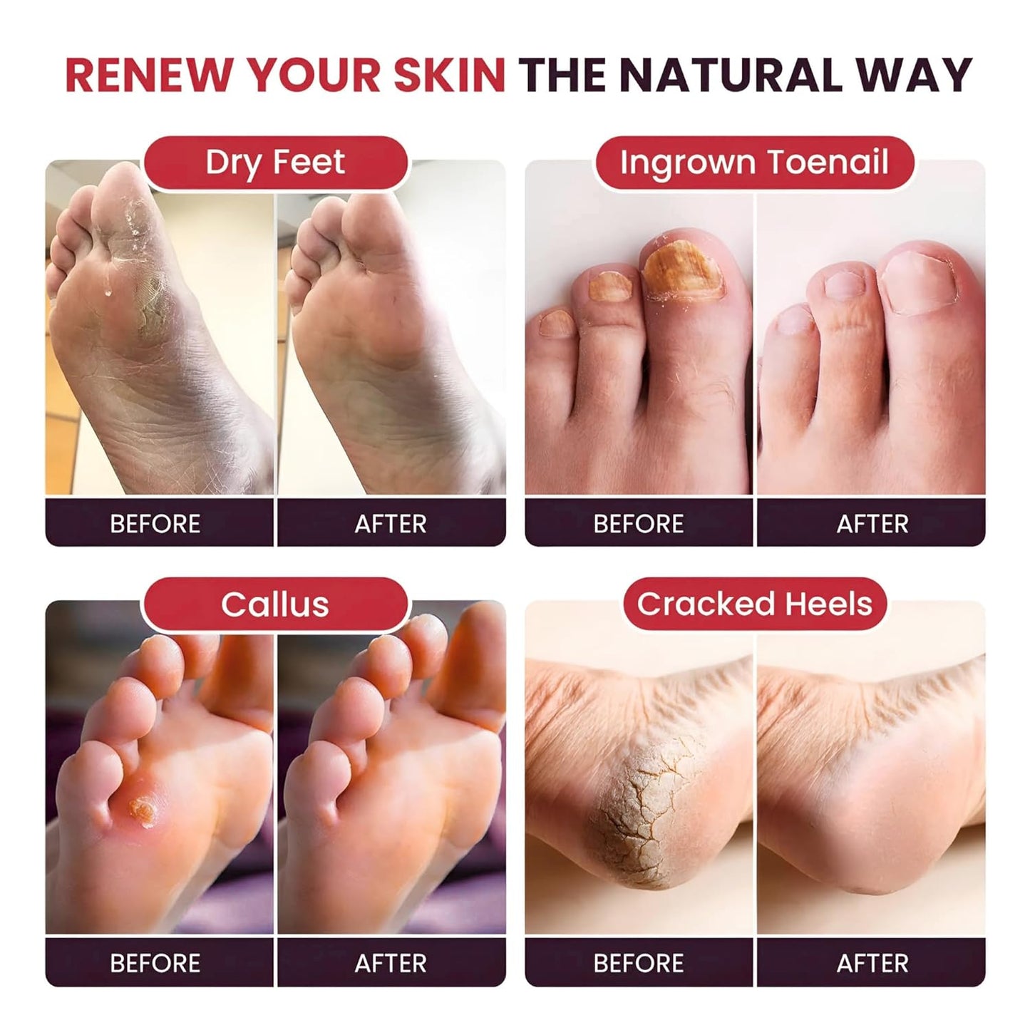 Muscle Care Foot Soak with Epsom Salts – Refreshing Blend for Relaxation & Foot Care – Helps Soften Skin – Soothes Tired Feet, Invigorating Scent, Spa Pedicure – Made in USA – 16oz (Pack of 2)