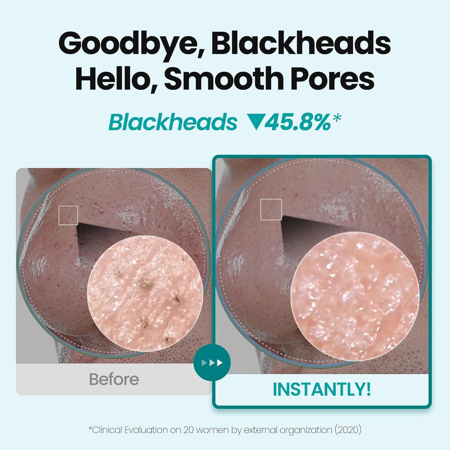 [K-Beauty] Blue Tansy Oil to Foam - All-in-One Korean Face Wash OilBased Foaming Facial Cleanser - Excess Sebum & Oil Control - Makeup Deep Cleansing Oil for All Skin Types (3.88 fl oz)