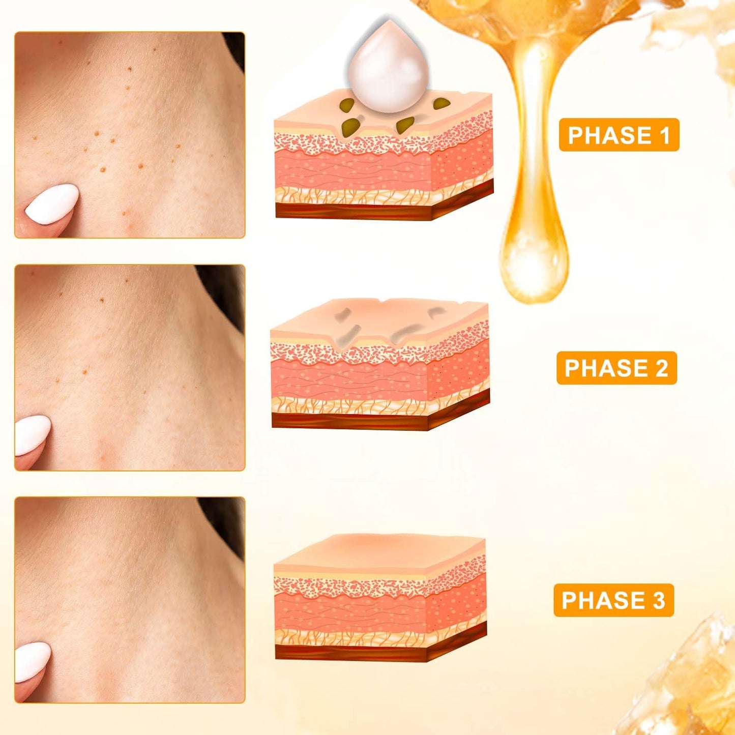 Bee Venom Cream, Professional Bee Venom Cream for All Parts of Neck, Waist, Back, Hands, Feet, and Legs（2Pcs）