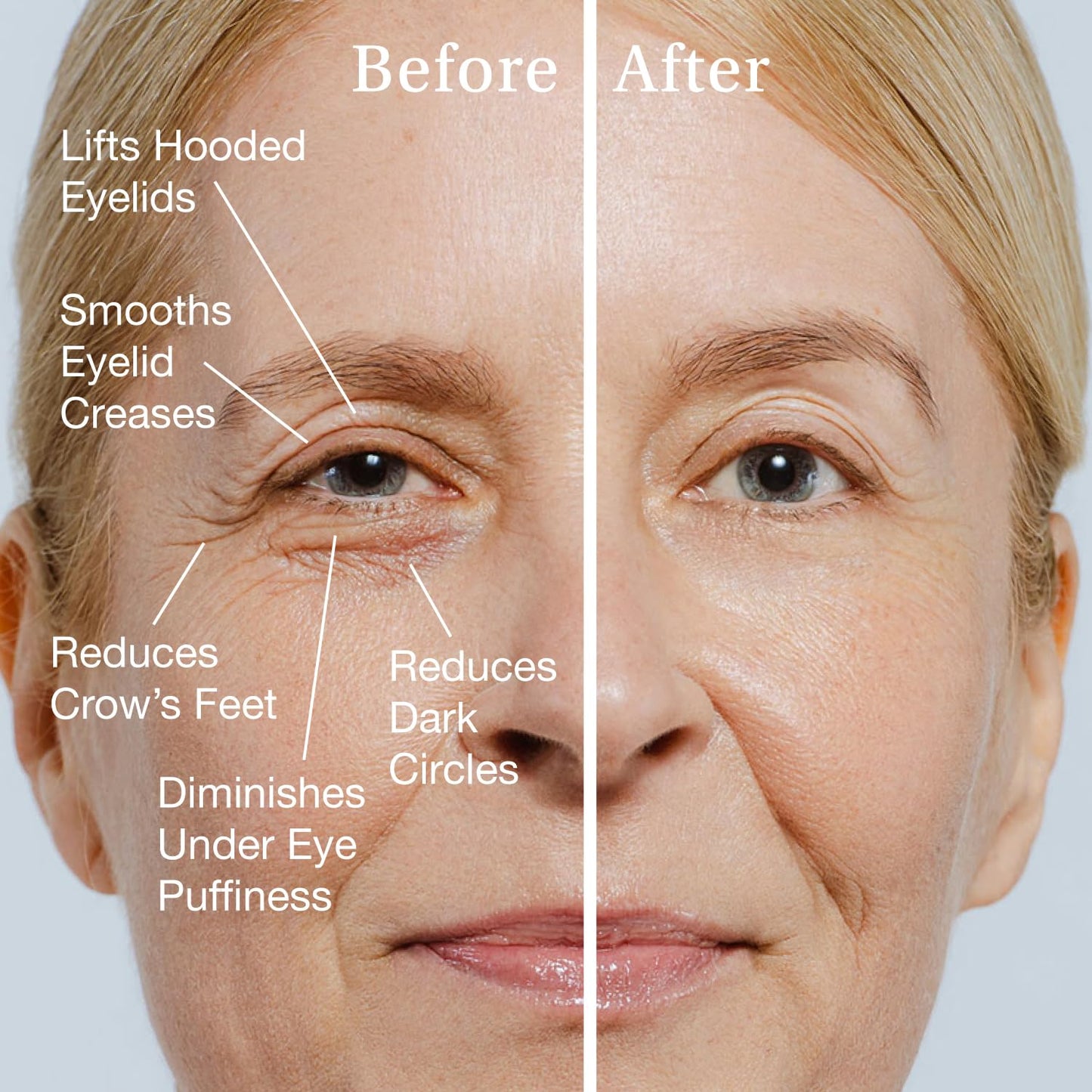 SBLA Eye Lift Wand – Anti-Aging Serum for Eyelids, & Eye Area - With SBLA66Peptide™, Caffeine, Hyaluronic Acid, Niacinamide & Vitamin C - Smooths, Lifts Hooded Lids, Brightens Eyes, Reduces Puffiness