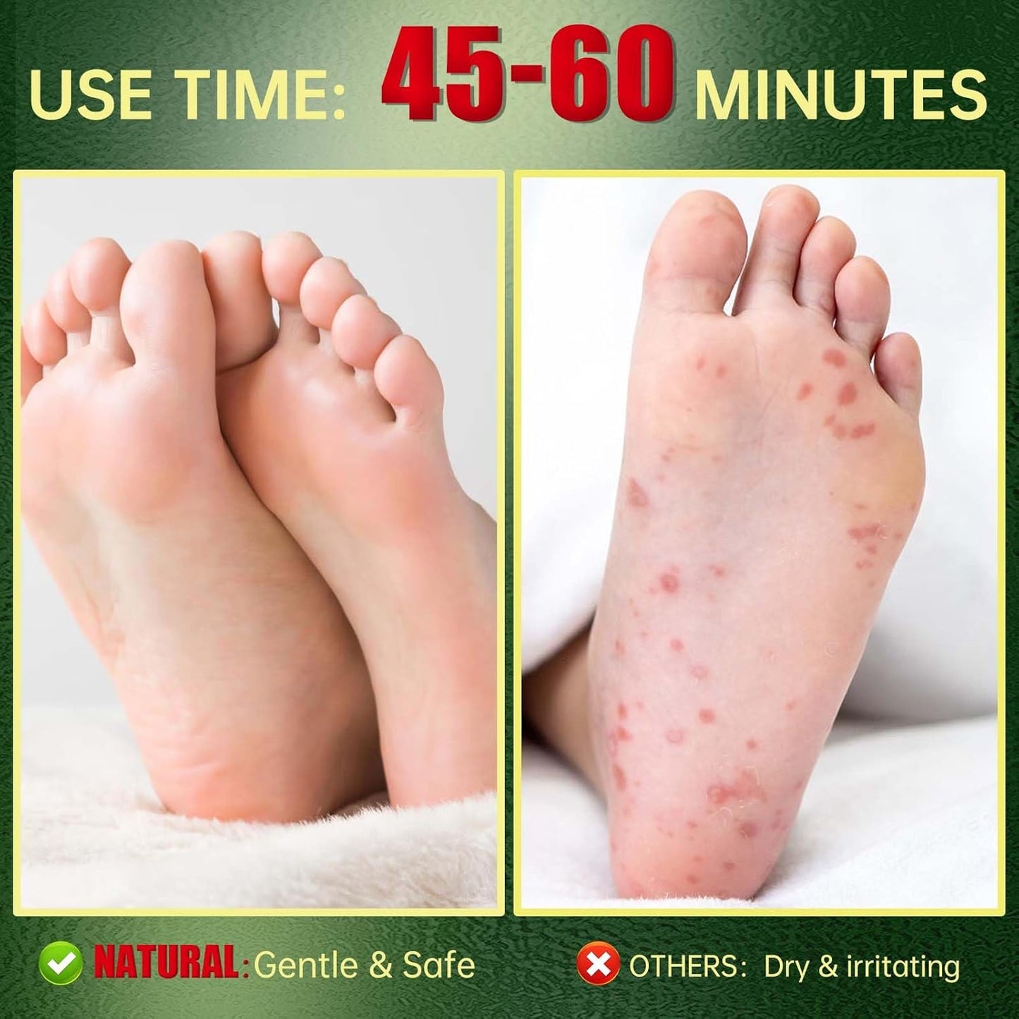 Foot Peeling Mask, Natural Exfoliating Foot Mask, Dead Skin Callus Remover Repair Heels, Hydrating Foot Care for Dry Cracked Feet (9 Pack)