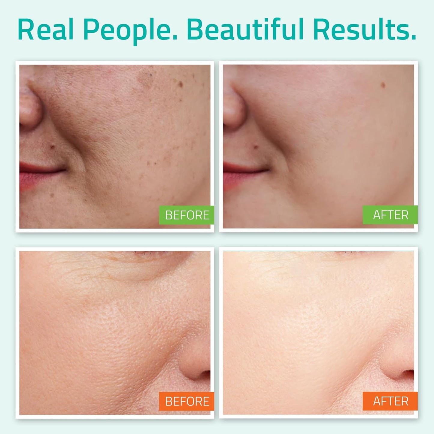 YEOUTH Hyaluronic Acid Serum with Vitamin C, Face Toner, Face Moisturizer, Skin Care Set for Radiant and Smooth Skin, Gifts for Women, Self Care Routine, Skin Care Gift Set 3-Piece