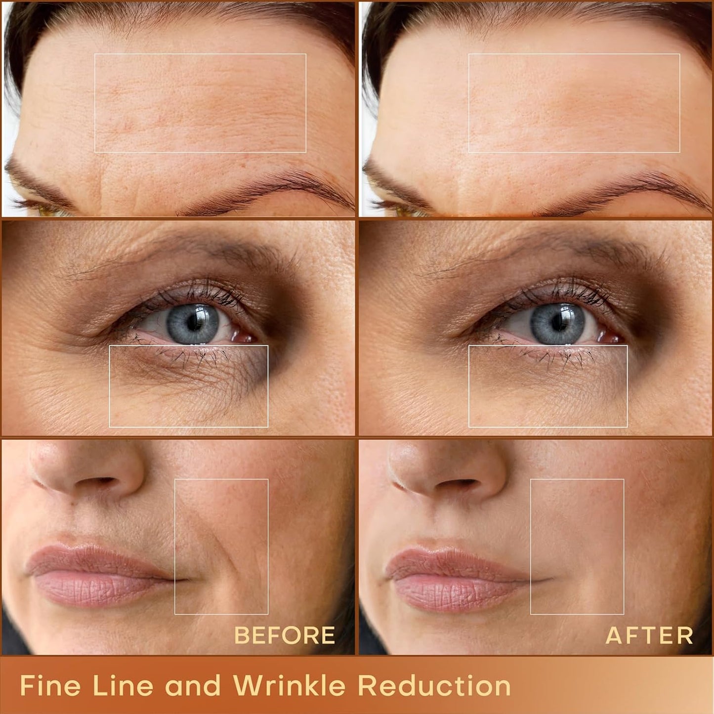 MLAY Professional RF Beauty Machine, Radio Frequency Face Machine with 2 Probes, at Home Radio Frequency Skin Tightening for Lifting, Wrinkle Reducing, Anti Aging - Salon Effects（Gel Included）