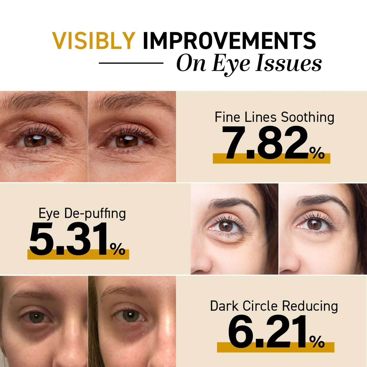 CITYGOO Snail Eye Stick for Dark Circles: Anti Wrinkle Snail cream Eye Puffiness Treatment (Snail Eye Stick)