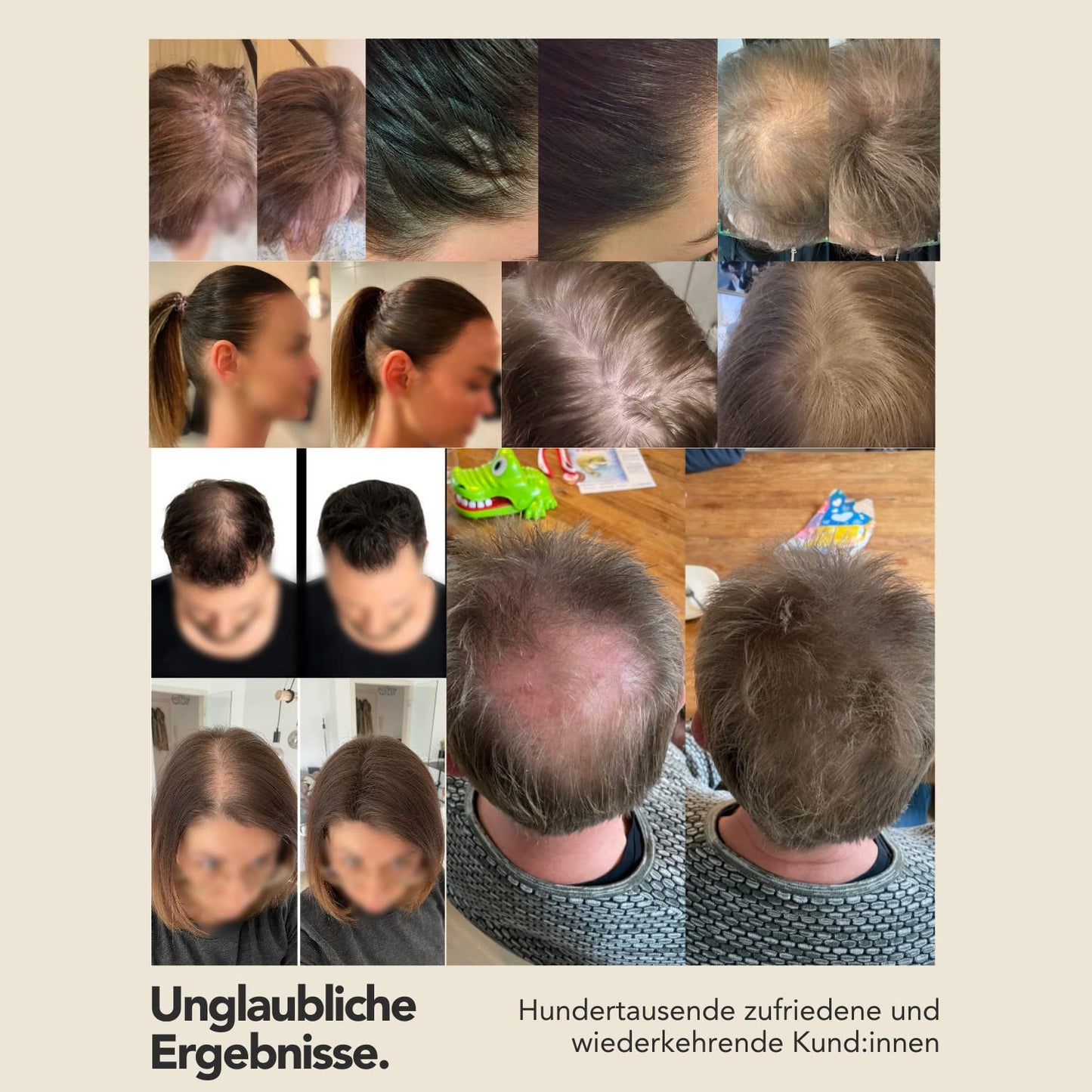 IMPERIO Hair Building Fibers for Thinning Hair - 26g Premium Hair Fibers for Women & Men in Hairdresser Quality - Hair thickening in less than 20 seconds (Light Blonde)