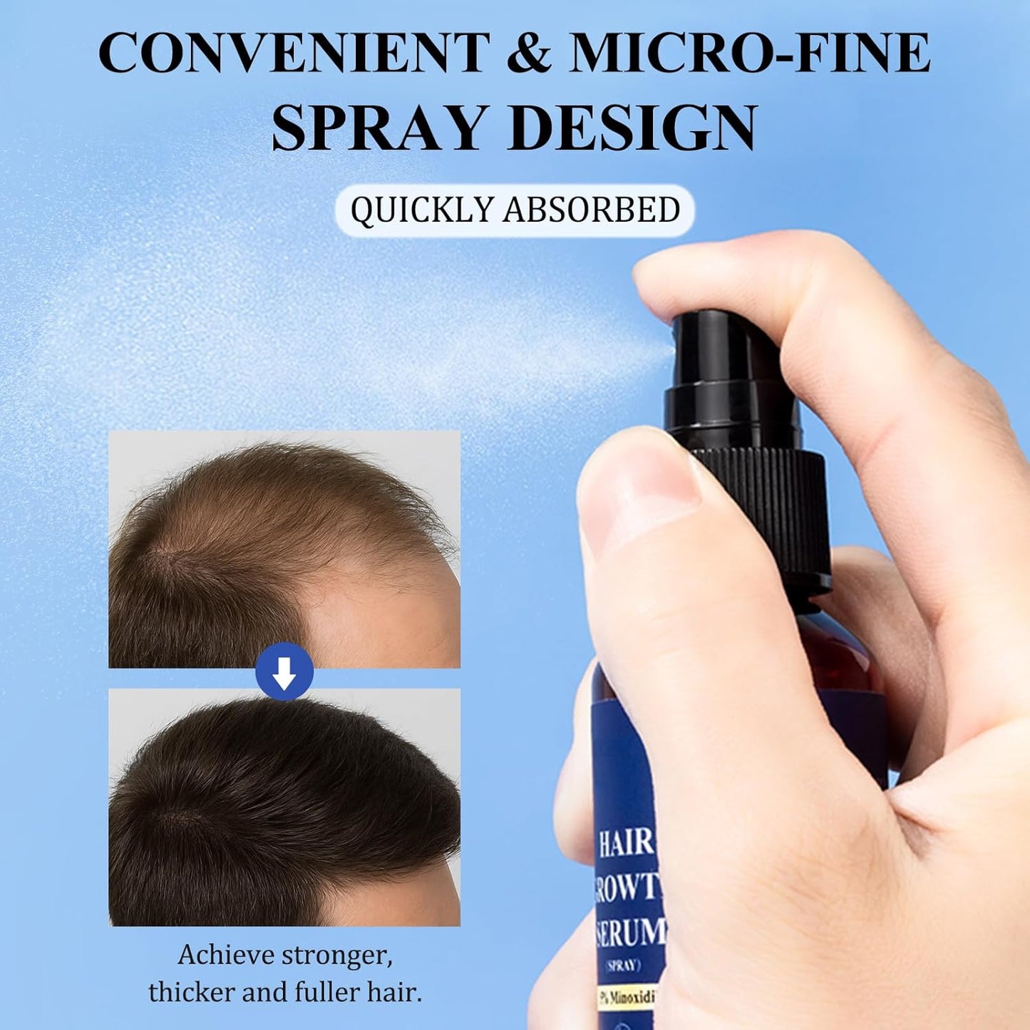 5% Minoxidil Hair Growth Spray - 3PCS Minoxidil for Women Hair Growth, Minoxidil for Men Hair and Beard, Hair Loss Treatment to Reduce Thinning & Regrow Hair (60ml*3 Pack)