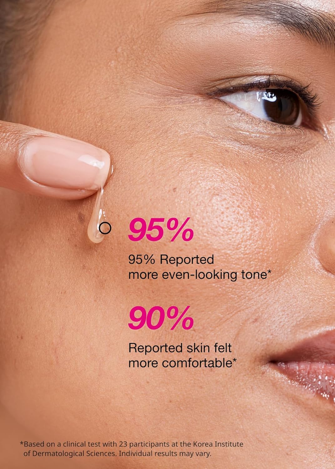 ISOI Blemish Care Up Serum for Face, Vegan Hydrating Serum for Smooth & Glass Skin Effect, Skin Barrier & Moisture Balance for Women, Arbutin, Korean Skin Care (2.36 fl. oz, 70ml)