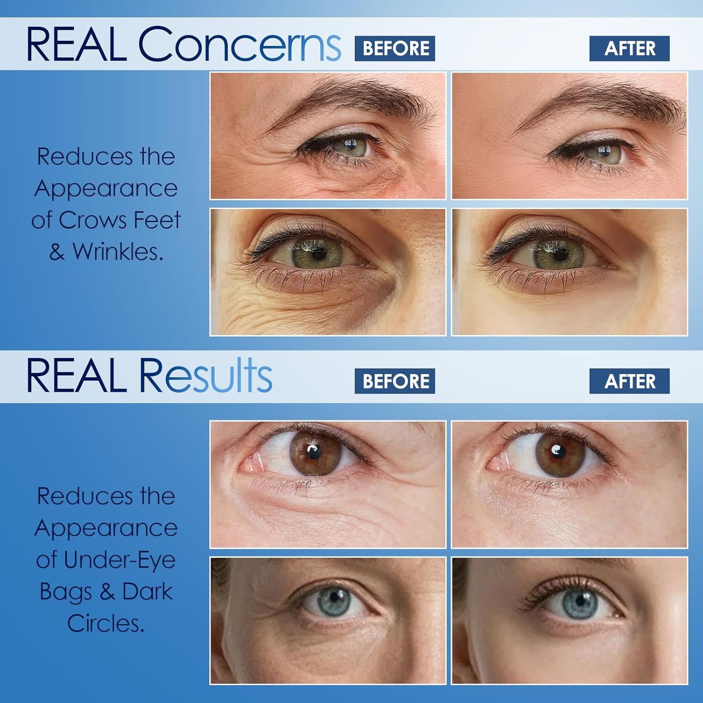 Instant Eye Serum, for Under-Eye Bags, Dark Circles & Wrinkles - Powered by Peptide & Collagen, Smooth and Moisturize (0.17 Fl. OZ (Pack of 1))