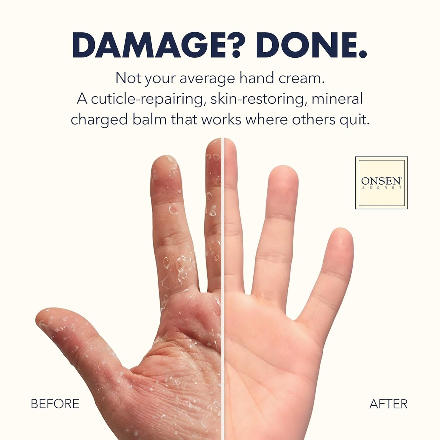 Onsen Hand & Cuticle Rescue Cream | Organic Nail Strengthener & Balm | Dry, Cracked Hands, Elbows & Feet | Shea Butter, Tsubaki & Jojoba Oil | Nail Repair & Growth, Vegan - 2 Pack (0.88 oz)