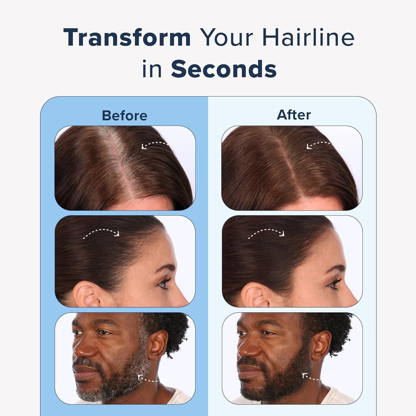 TRUHAIR Jumbo Color & Conceal Waterproof Root Touch Up Hair Color Concealer - Hair Cover up for Gray Coverage and Hairline Filling - 11 Hair Colors Available (Dark Brown)