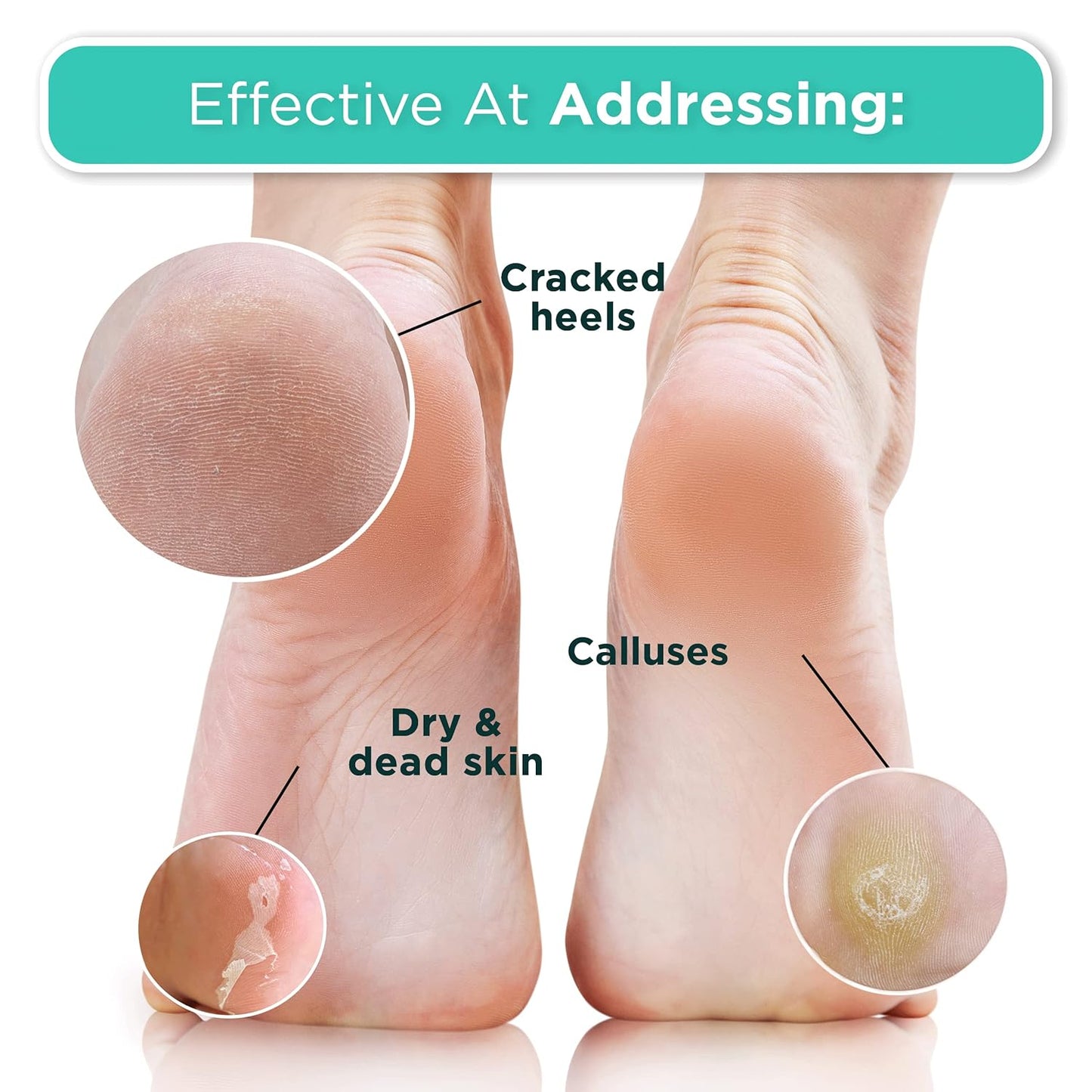 DERMORA Foot Peel Mask | Skin Exfoliating Foot Masks | Dry, Cracked Feet, Callus, Dead Skin Remover | Baby Soft Feet | Peach Scent | Pack of 2 | Regular