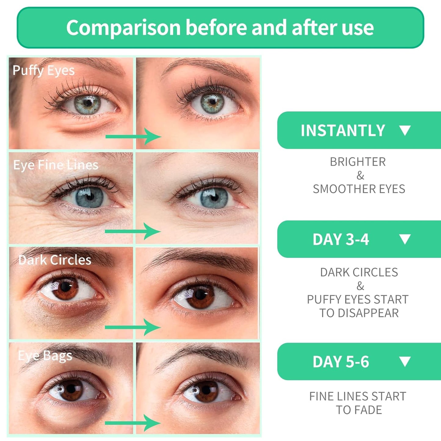 BREYLEE Aloe Vera Eye Masks– 60 Pcs - Puffy Eyes and Dark Circles Treatments – Look Younger and Reduce Wrinkles and Fine Lines Undereye, Improve and Firm eye Skin - Pure Natural Material Extraction