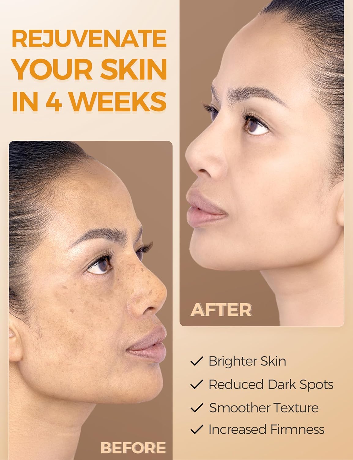 Vitamin C Serum with Niacinamide & Ethyl Ascorbic Acid: Brightening, Moisturizing Face Serum for Dark Spots | Hyperpigmentation & Anti-Aging Treatment | Korean Synergy Formula 1.01oz