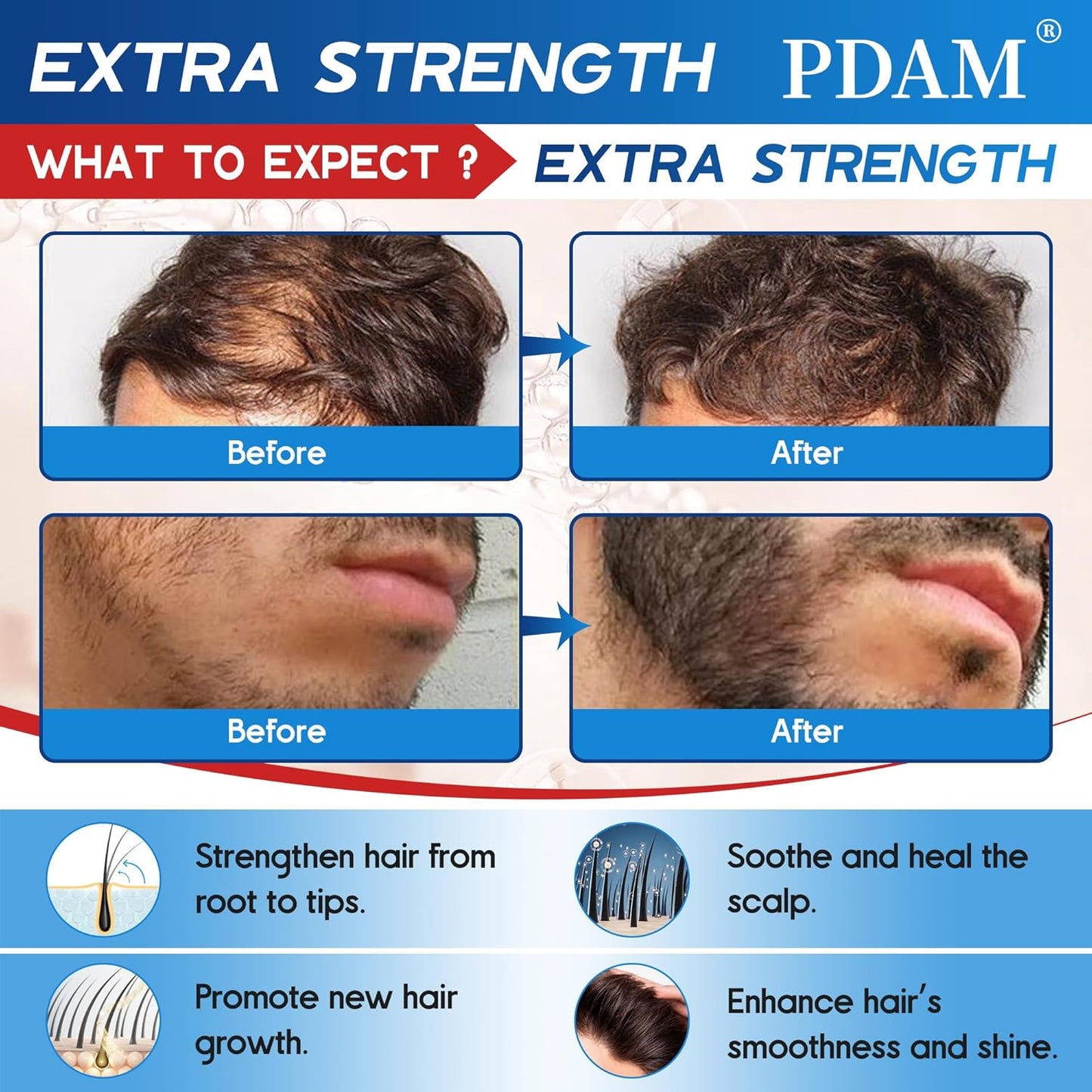 Minoxidil for Men Hair Growth Spray - 5% Topical Minoxidil for Hair and Beard Growth, Extra Strength Hair Regrowth Treatment for Hair Loss & Thinning Hair, 2 Fl Oz (60ml) *2