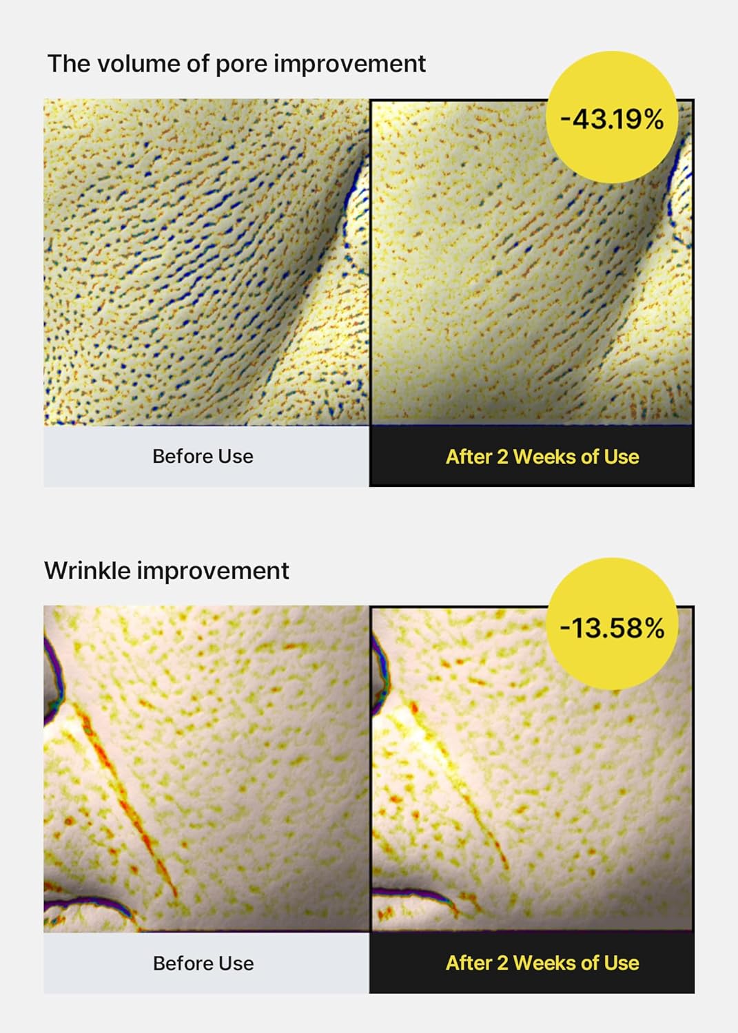 celimax The Vita A Retinol Shot Tightening Serum | with Pure Vitamin A Retinol, Peptide, Pore Minimizer, Wrinkles & Fine Lines, Firmer Skin, Anti-Aging, Skin Smoothing 30ml