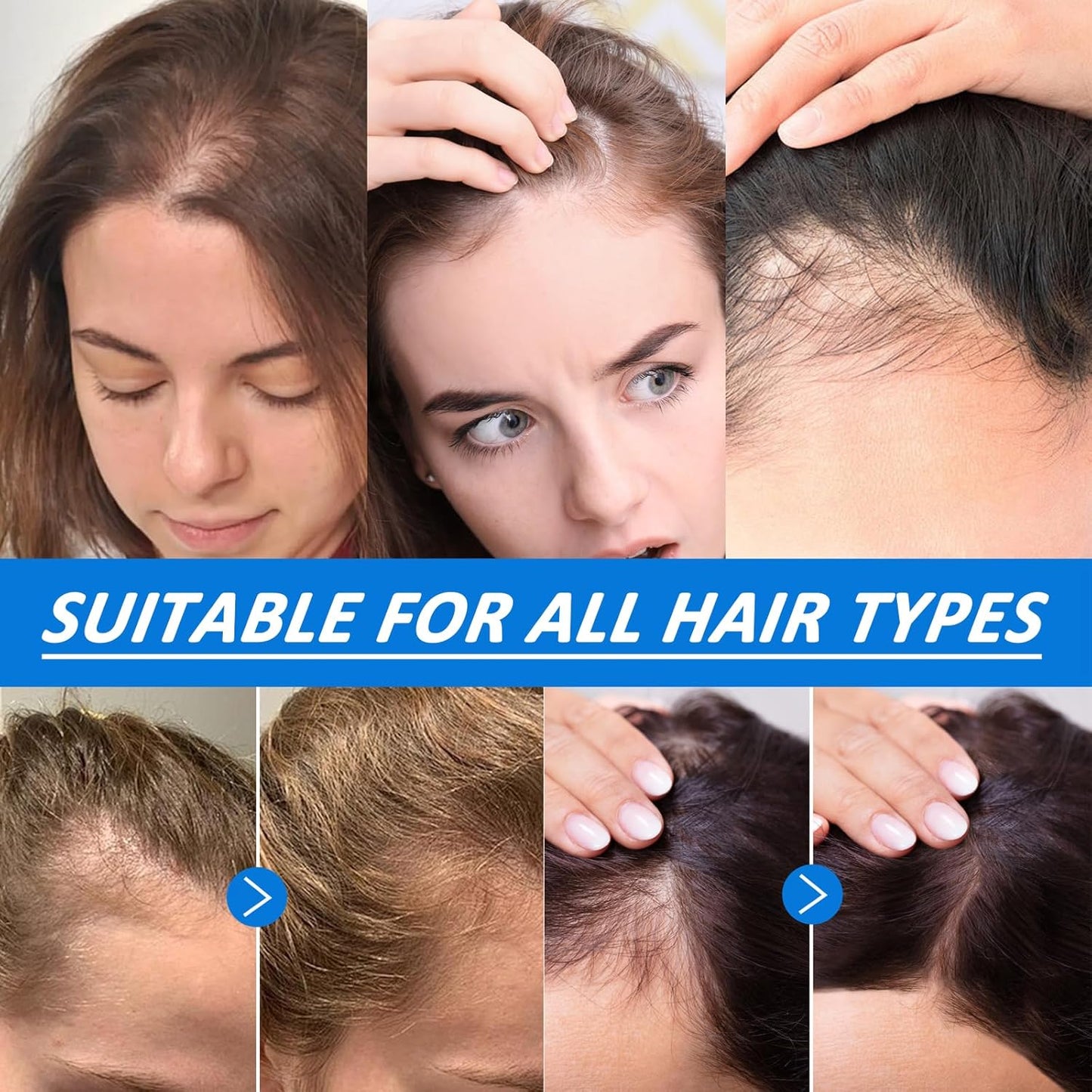 Ovela Hair Ampoule Serum, Scalpy Hair Growth Serum for Hair Loss & Thinning | Hair Growth Serum Women & Men w/Salicylic Acid, Menthol, Dexpanthenol | Non-Greasy, Lightweight (2 PCS)