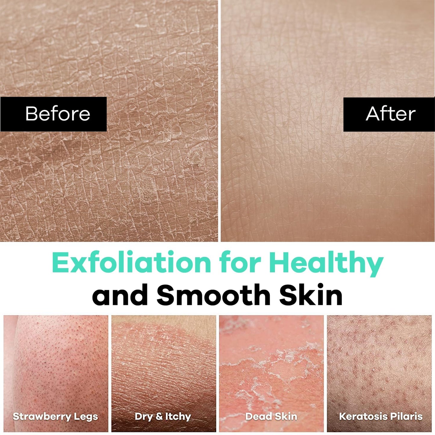 Dermasuri Deep Exfoliating Glove – Korean Exfoliating Mitt, Body Scrubber for Shower, Buffs Dry & Dead Skin, Keratosis Pilaris Treatment, Body Scrub, Skin Exfoliator for Men & Women, Reusable - XL