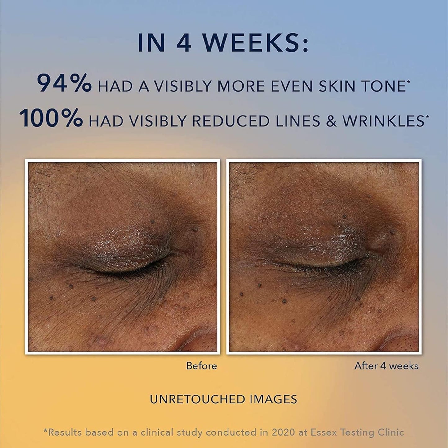 RoC Multi Correxion Revive + Glow 10% Active Vitamin C Serum for Face, Daily Anti-Aging Wrinkle and Skin Tone Skin Care Treatment, Brightening Serum, 1 Fluid Ounce