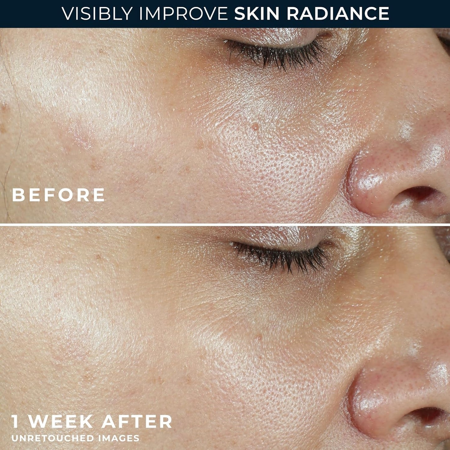 RoC Multi Correxion Revive + Glow Vitamin C Sunscreen Broad Spectrum SPF 30 Face Moisturizer (1.7 oz) with Retinol Eye Cream Packette